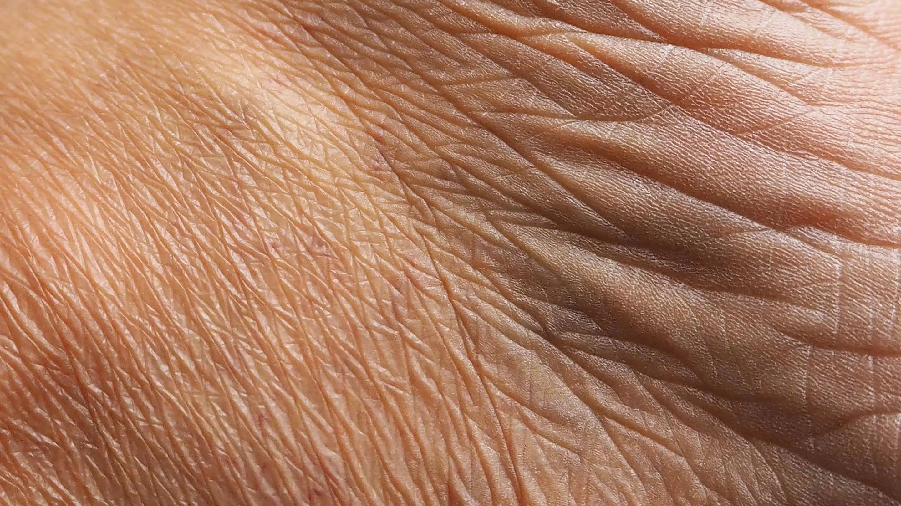 皮膚科専門医ロバート・シェマー:“あらゆる皮膚のお悩み解決は、「正しい知識」を身につけることから始まる”